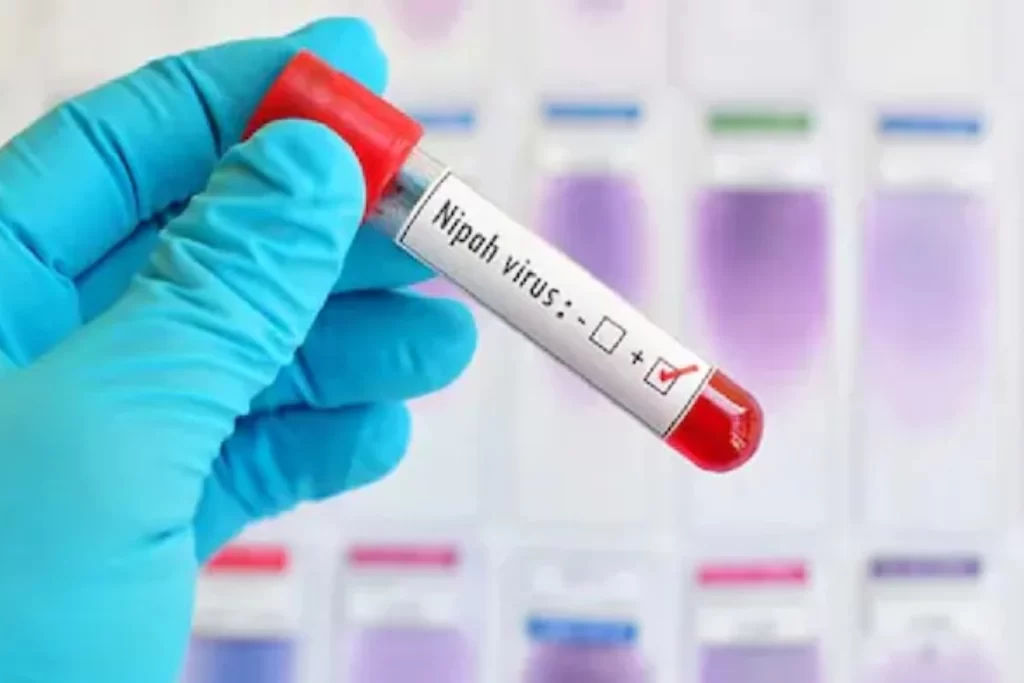 Bats at Alipore Zoo Undergo Nipah Virus Testing as Health Authorities Expand Surveillance in West Bengal