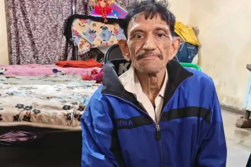Indore Beggar